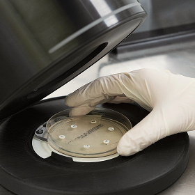 Taking a photo of the agar plate