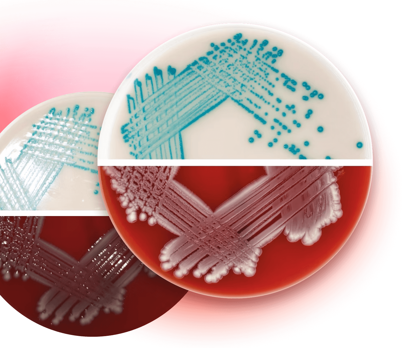 Agar plate results comparison